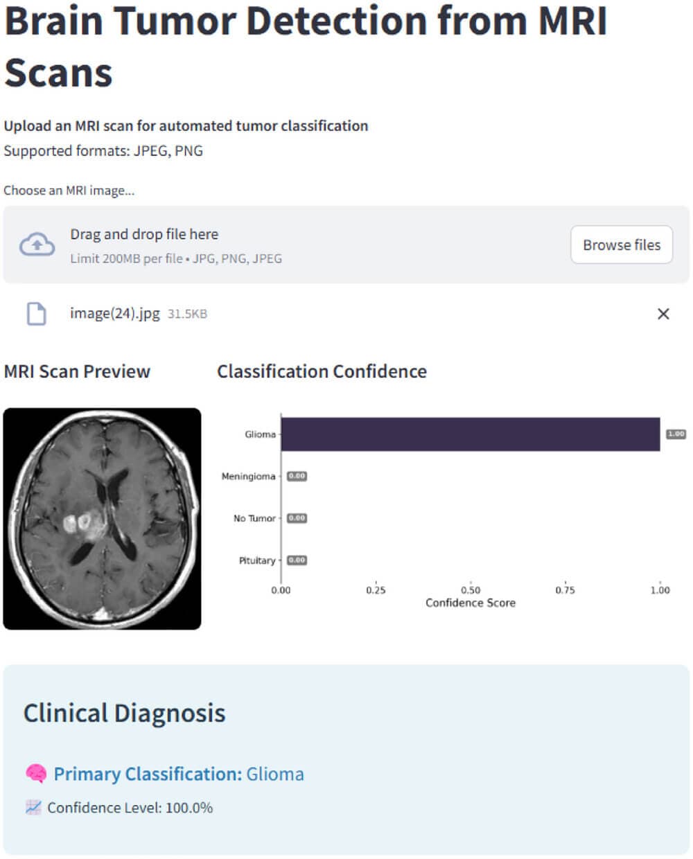 BTdiagAI: A Web‑Deployed Hybrid Framework for Brain Tumor Classification Using Optimized MRI Preprocessing and Deep Learning Fusion
